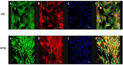 Microgravity Modifies the Phenotype of Fibroblast and Promotes ...