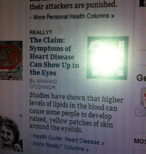 Image result for Eye Heart Connection