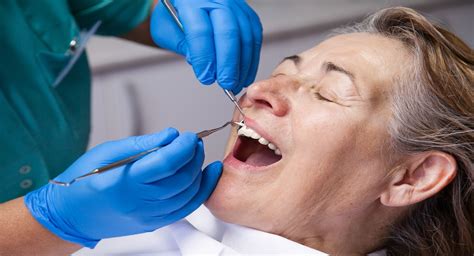 Tooth Extraction 的图像结果