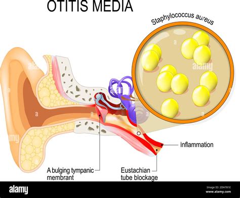 Ear diagram hi-res stock photography and images - Alamy