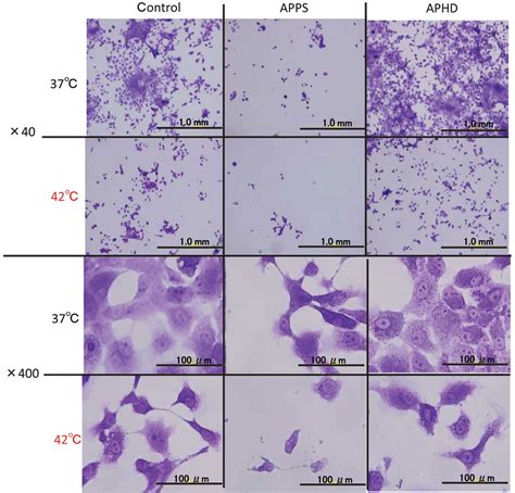 Crystal Violet Staining