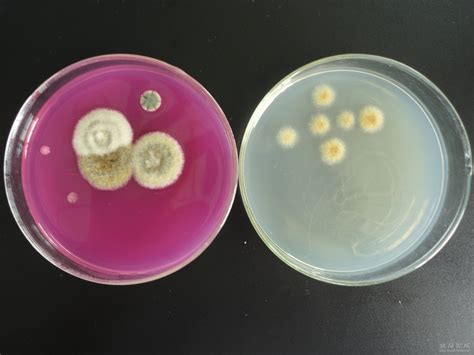 微生物简述（4）——真菌的世界