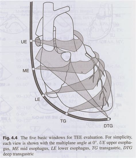 Pedi cardiology: TEE - Probe position terminology