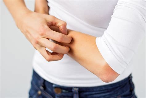 How to prevent keloid scars | CredoWeb
