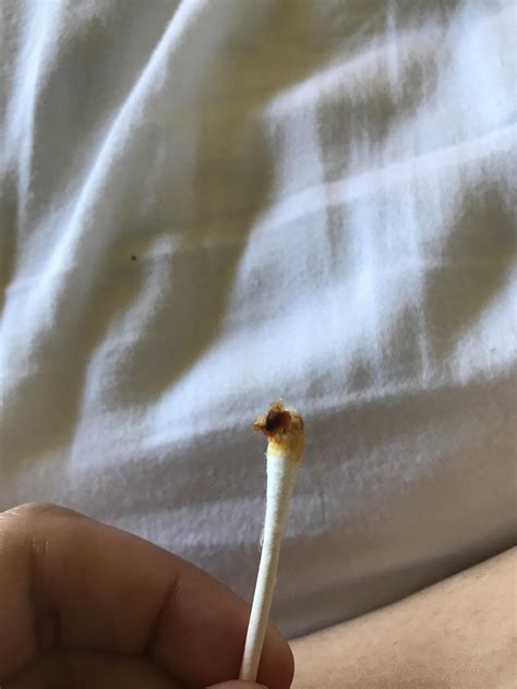 wow : r/earwax