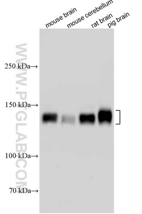 CACNA2D1 antibody (27453-1-AP) | Proteintech