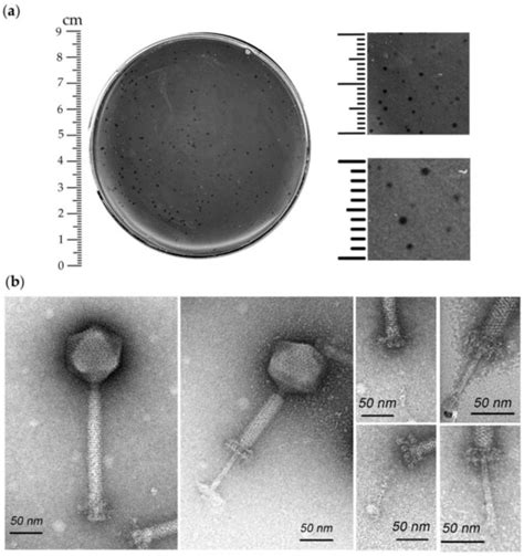 Bacteriolytic Potential of Enterococcus Phage iF6 Isolated from ...