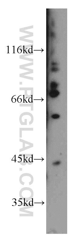FMRP antibody (13755-1-AP) | Proteintech