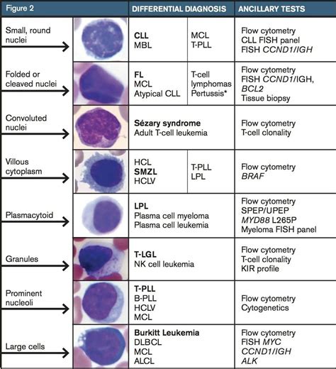 Manual Differential Lymphocytes High at John Hipple blog