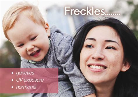 What is Freckles and What Causes Freckles? | Eeva Medical Clinic
