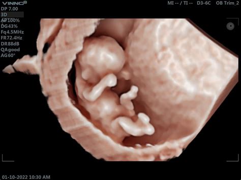 Image result for Alien 9 Design