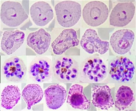 Red Blood Cell Stages of Pl [IMAGE] | EurekAlert! Science News Releases