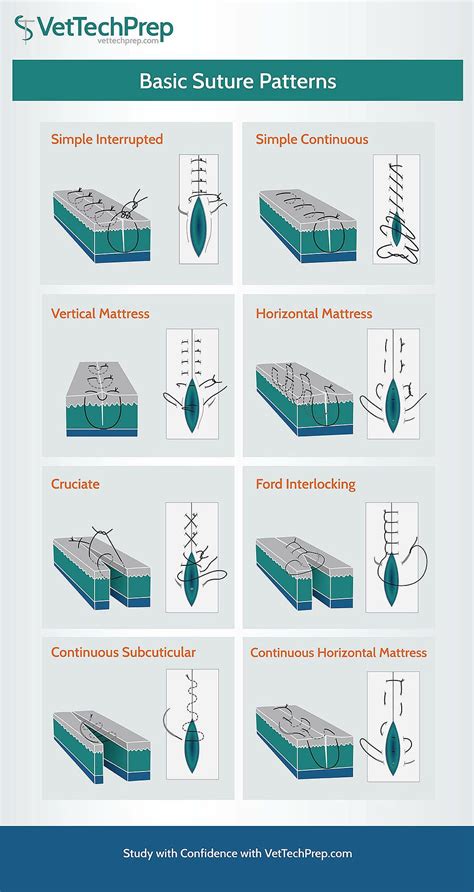Basic Interrupted Suture 的图像结果