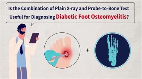 Combination of Plain X-ray and Probe-to-Bone for Diagnosing Diabetic ...