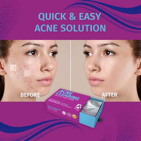 Best Acne Patches with Salicylic Acid – Fast & Invisible Care