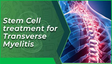 Transverse Myelitis Treatment