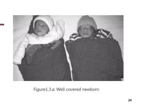 Hypothermia in newborn | PPSX