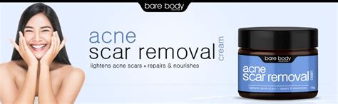 Bare Body Essentials Acne Scar Removal Cream, Acne scar & Pimple ...