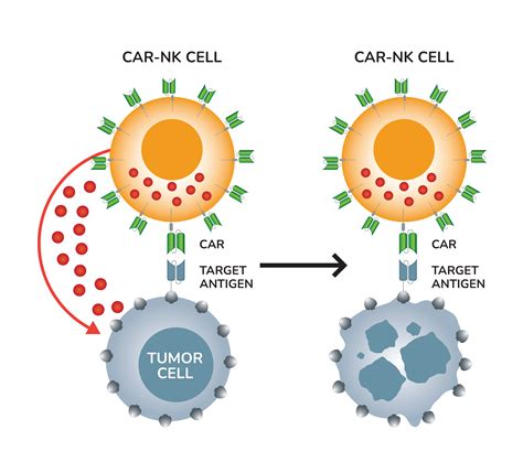 NK cells: NK cells in tumor immunity - Medical News
