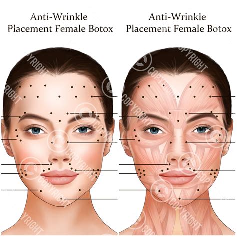 Image result for Botox Tutorial