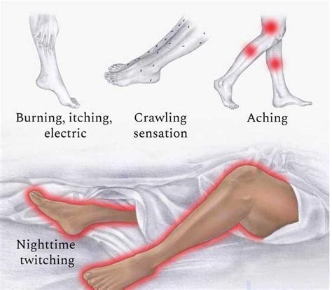 What is Restless Leg Syndrome? Scientists find genetic clues to treat ...