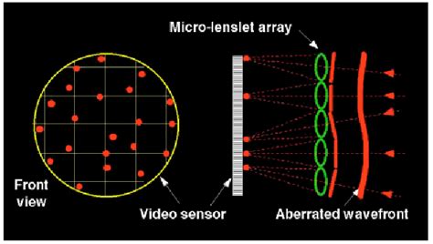 Advanced Optical Wavefront Technologies to Improve Patient Quality of ...