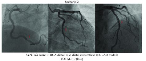 Image result for Syntax Score