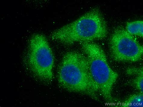 CCT5 antibody (67400-1-Ig) | Proteintech