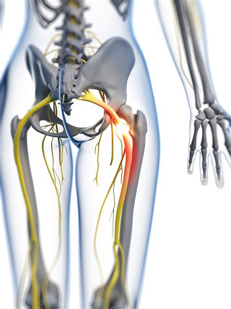 坐骨神经走行图 (第1页) - 图说健康