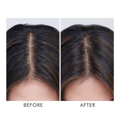 Oily Scalp Treatment – Moroccanoil