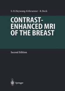 Contrast-Enhanced MRI of the Breast: Buy Contrast-Enhanced MRI of the ...