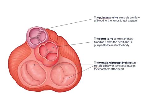 استبدال الصمام الأبهري عبر القسطرة – TAVR – Dr. Ritwick Raj Bhuyan