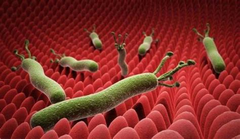 幽门螺杆菌感染会导致哪些疾病？|幽门螺旋杆菌|幽门螺杆菌|慢性胃炎|-健康界