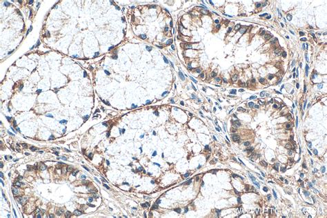 SLC1A5/ASCT2 antibody (68540-1-PBS) | Proteintech