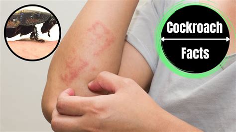 Cockroach Reaction 的图像结果