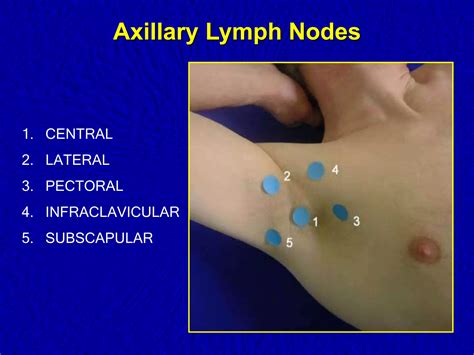 Axillary Lymph Nodes Examination.pptx