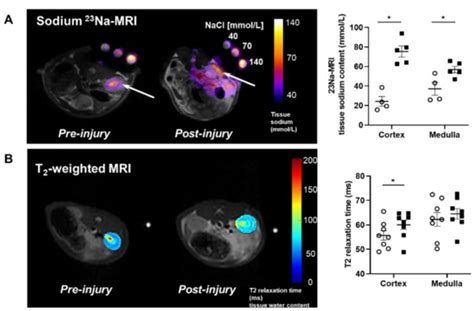 IJMS | Special Issue : Chronic Kidney Disease: Underlying Molecular ...