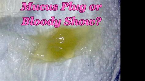 The Mucus Plug or Bloody Show- A Pregnancy Guide - YouTube