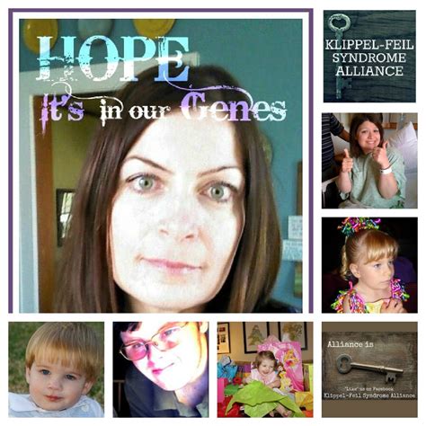Klippel Feil Syndrome Alliance Launched By KFS Patient Advocate - Global Genes