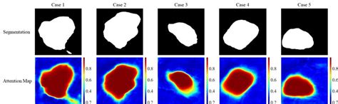 Image result for Text to Text Probability Decoder Only