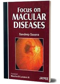 JaypeeDigital | Laser Photocoagulation in Diabetic Macular Edema