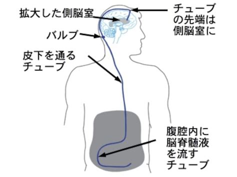 Image result for Systematic Coding Procedure