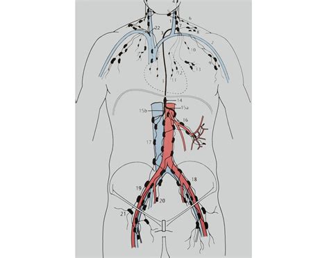 Image result for Lymphatic Trunks Model