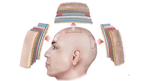 Scalp.pdf all the information...layers of scalp | PDF