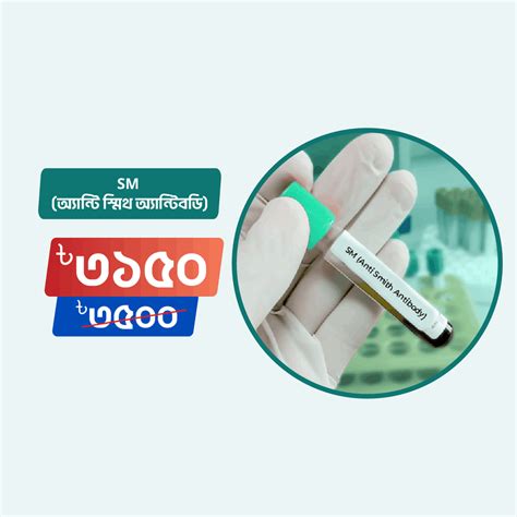 SM (Anti Smith Antibody) - Arogga Online Lab