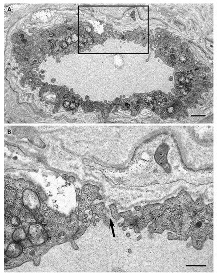 Biomedicines | Special Issue : Recent Advances in Amyloid Research ...