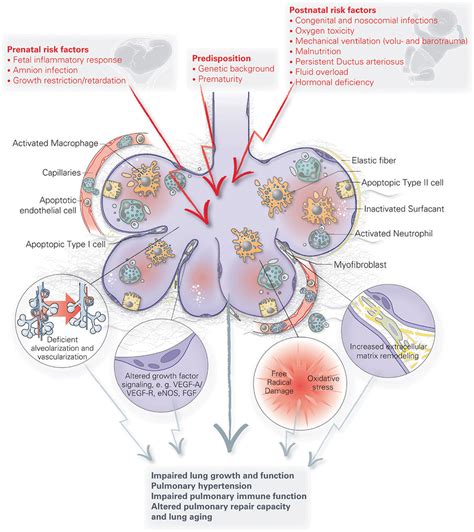 Frontiers | The Future of Bronchopulmonary Dysplasia: Emerging Pathophysiological Concepts and ...