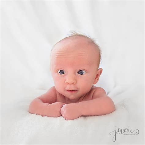 Crossed Eyes Neonatal at Maya Hurley blog
