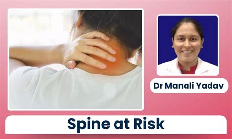 Spine at Risk: How Sedentary Lifestyles Are Silently Damaging Your Back ...