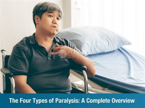 Paralysis 的图像结果